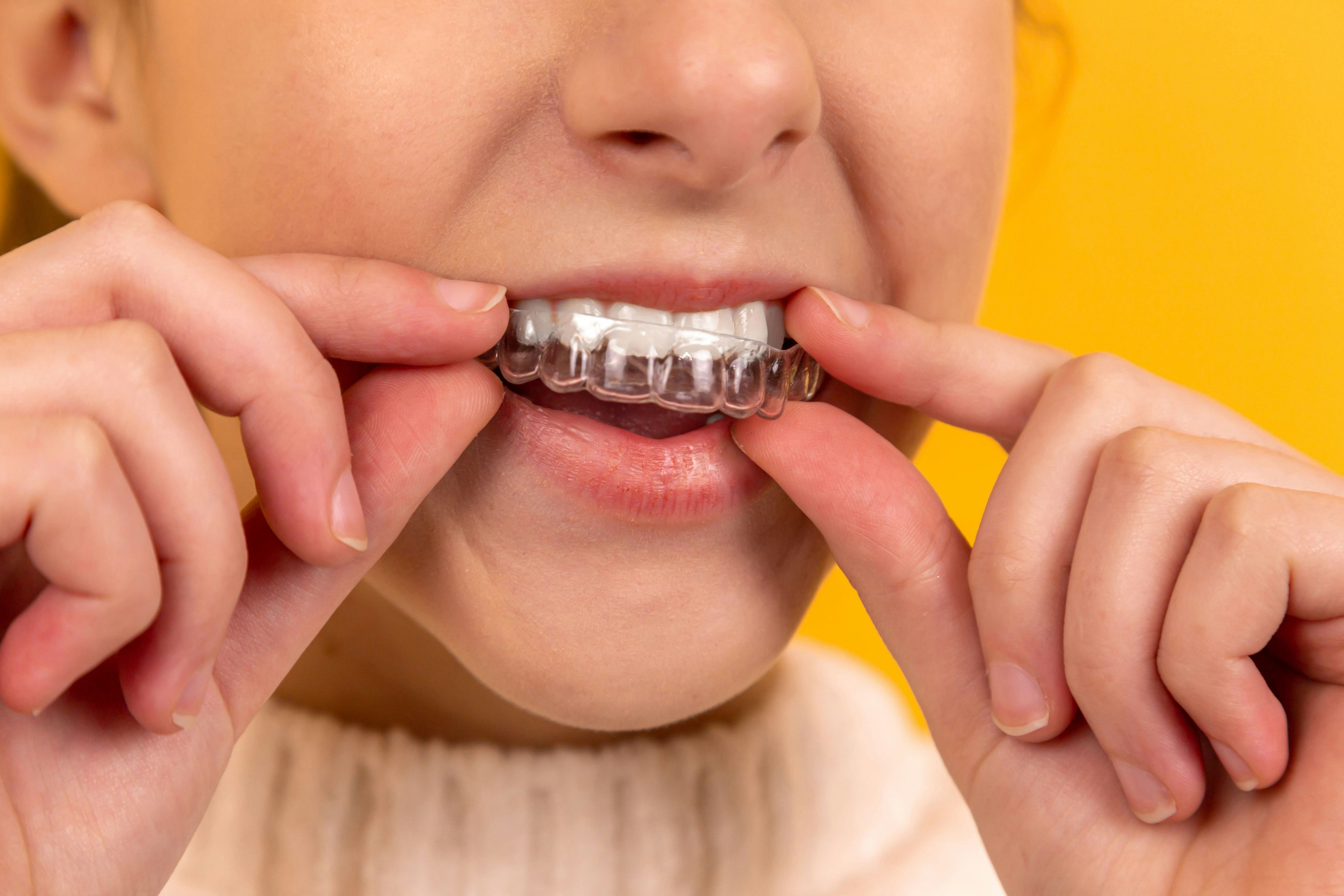 Woman putting on invisalign