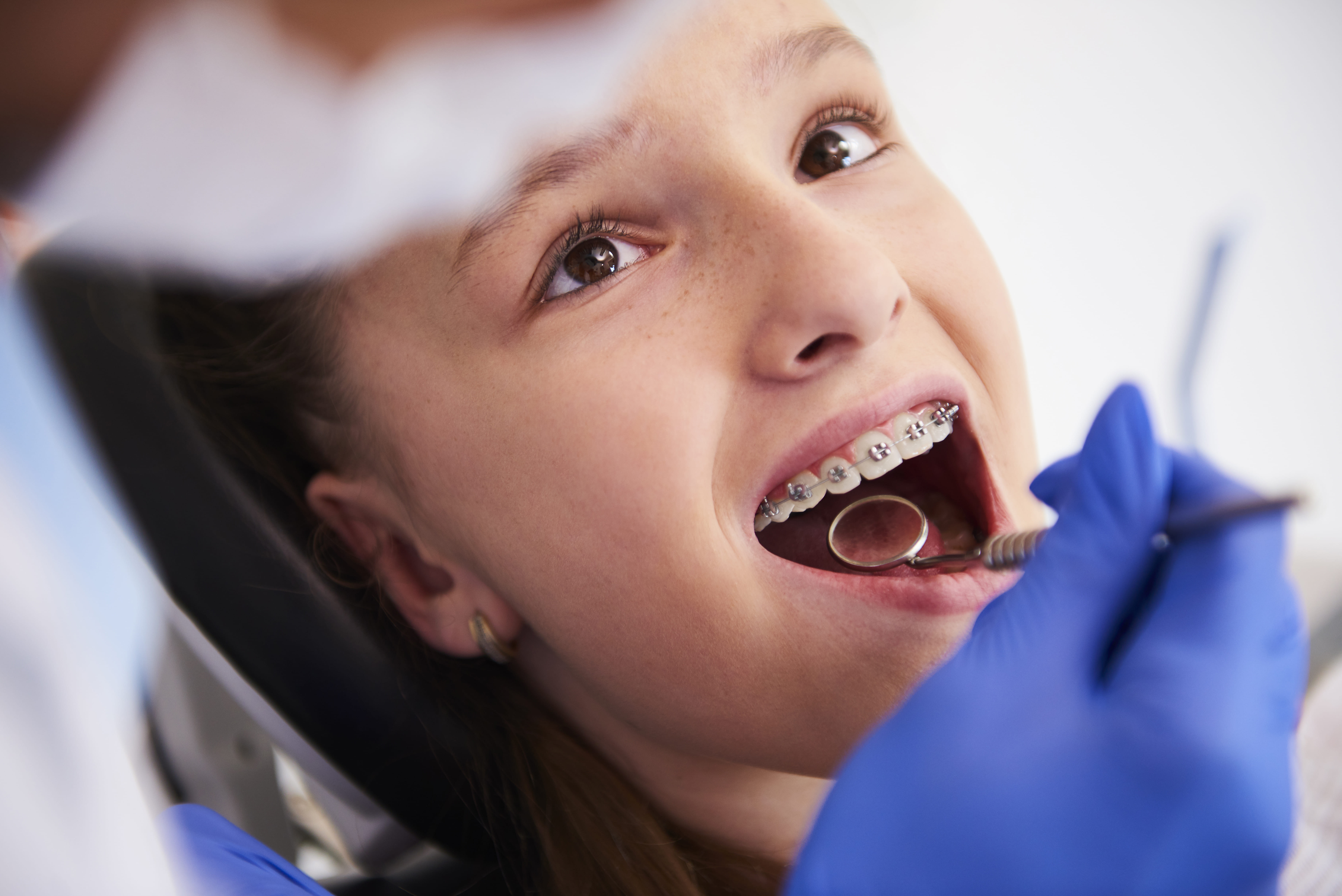 Child with braces receiving an orthodontic checkup at Frugé Orthodontics in Louisiana. Child with braces receiving an orthodontic checkup at Frugé Orthodontics in Louisiana.