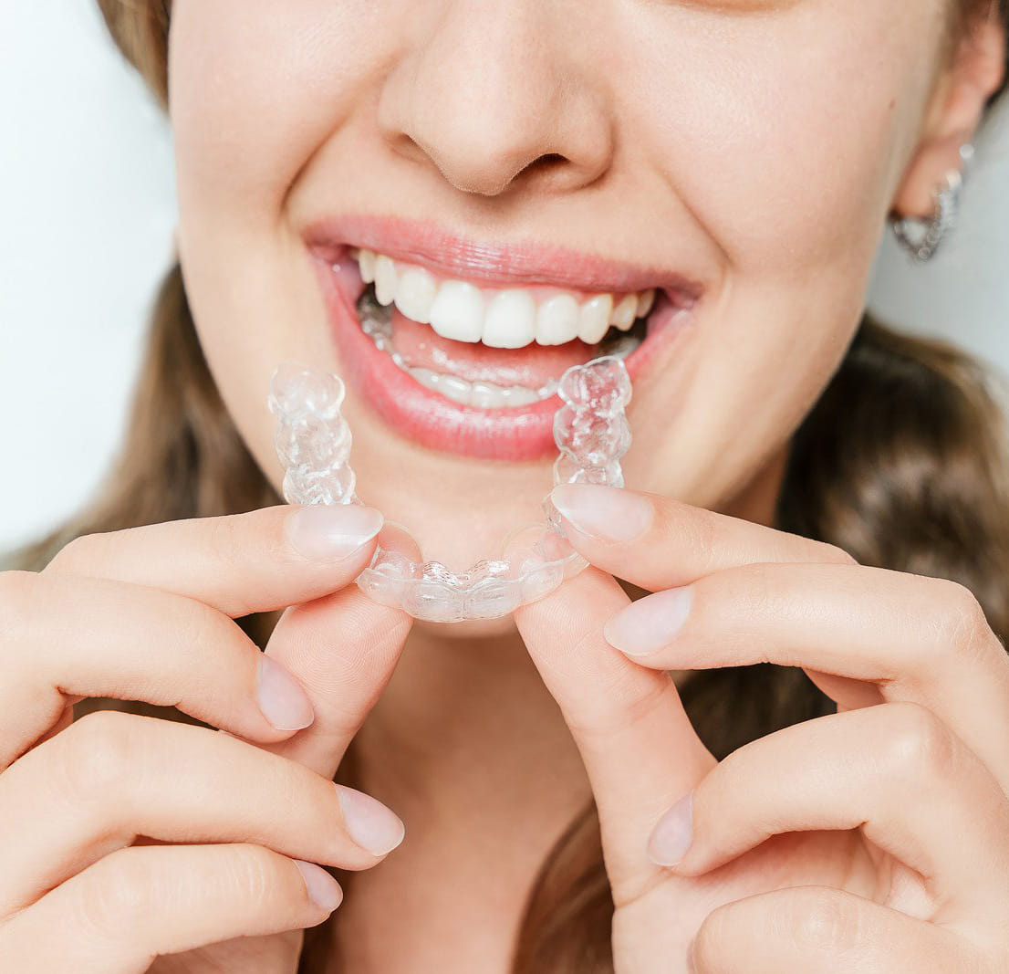Patient inserting clear aligner tray during orthodontic treatment