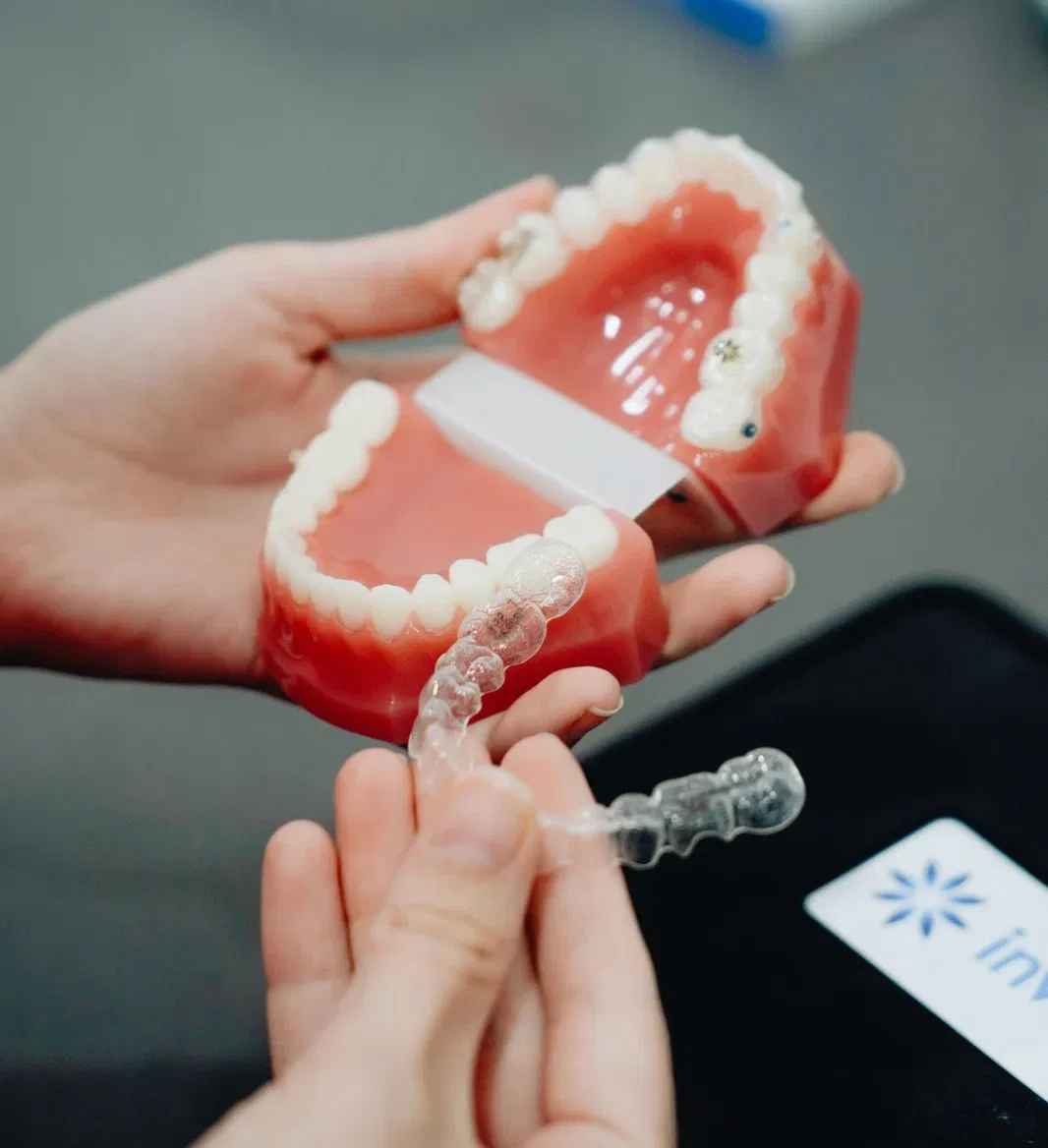 Close up of teeth with metal braces and pink elastic bands