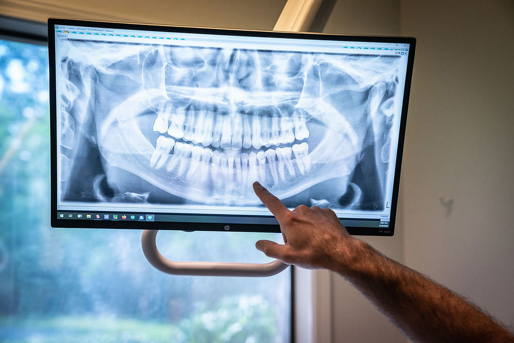 dental x-ray