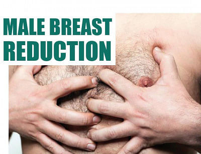 Male Breast Reduction