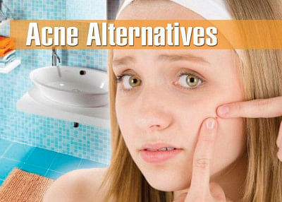 Acne Alternative Treatments